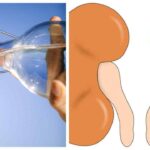 acqua-minerale-per-preservare-i-reni